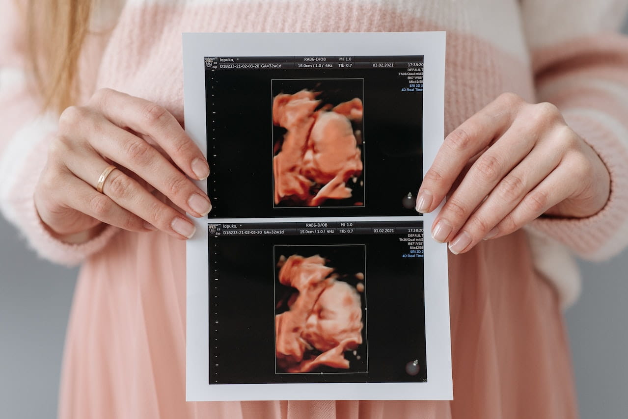 e/سونوگرافی حاملگی