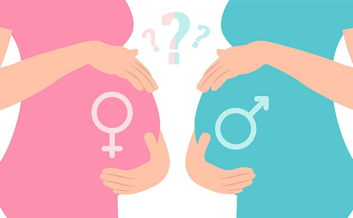 y/سونوگرافی تشخیص جنسیت(جنین پسر است یا دختر) 