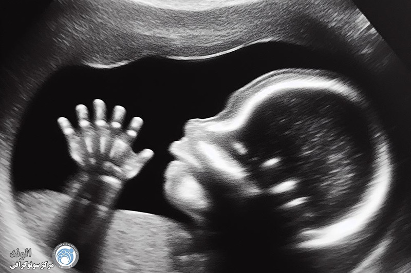 اسم آخرین سونوگرافی بارداری