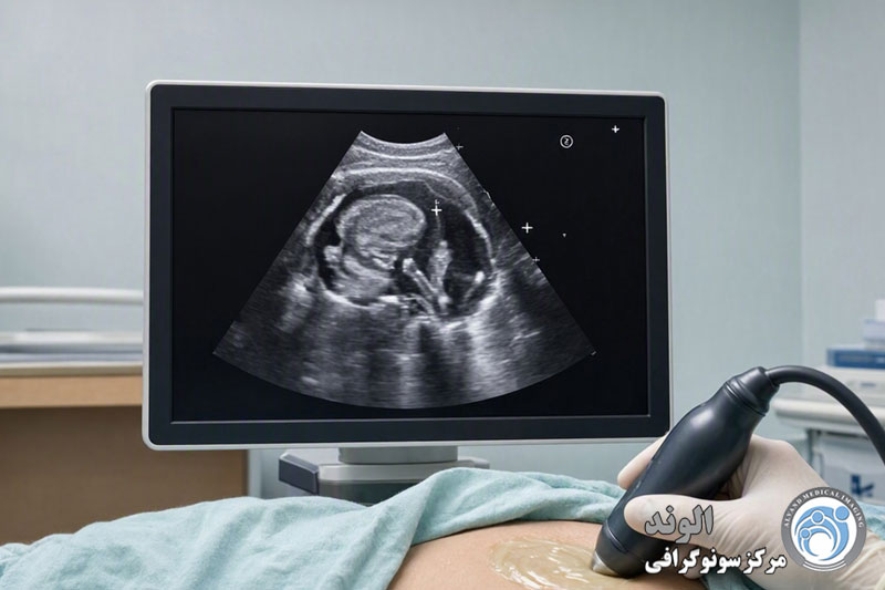 عدد نرمال سونوگرافی nt