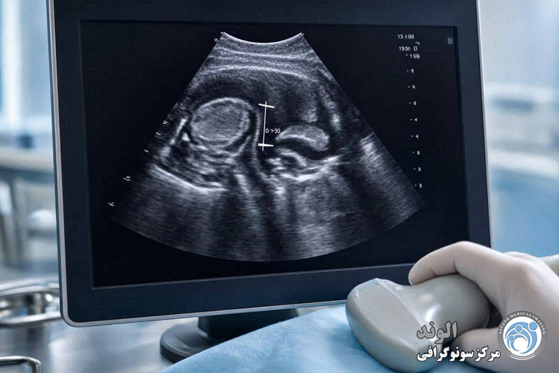 سونوگرافی NT چیست و چگونه انجام می شود؟