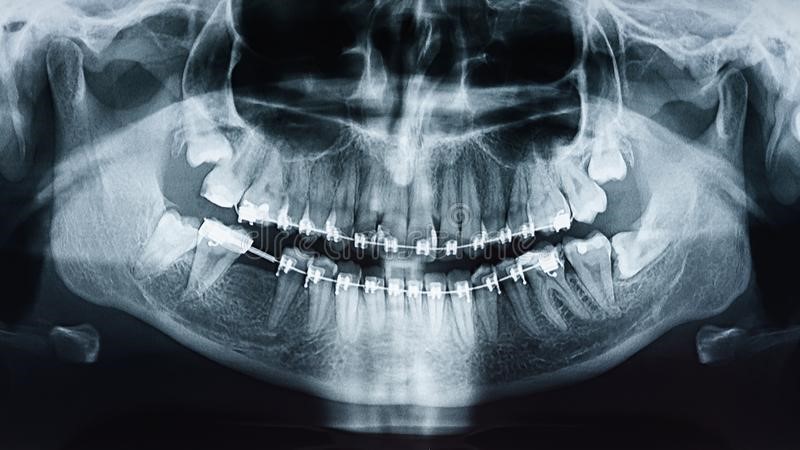 M/عکس دندان