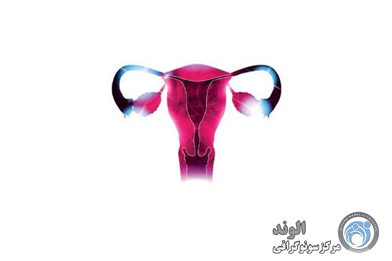 What is a color photo of the uterus?/عکس رنگی رحم چیست؟