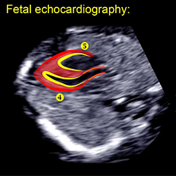 اکوی قلب جنین|اکو قلب جنین و اکوکاردیوگرافی جنینی|اکوکاردیوگرافی جنین